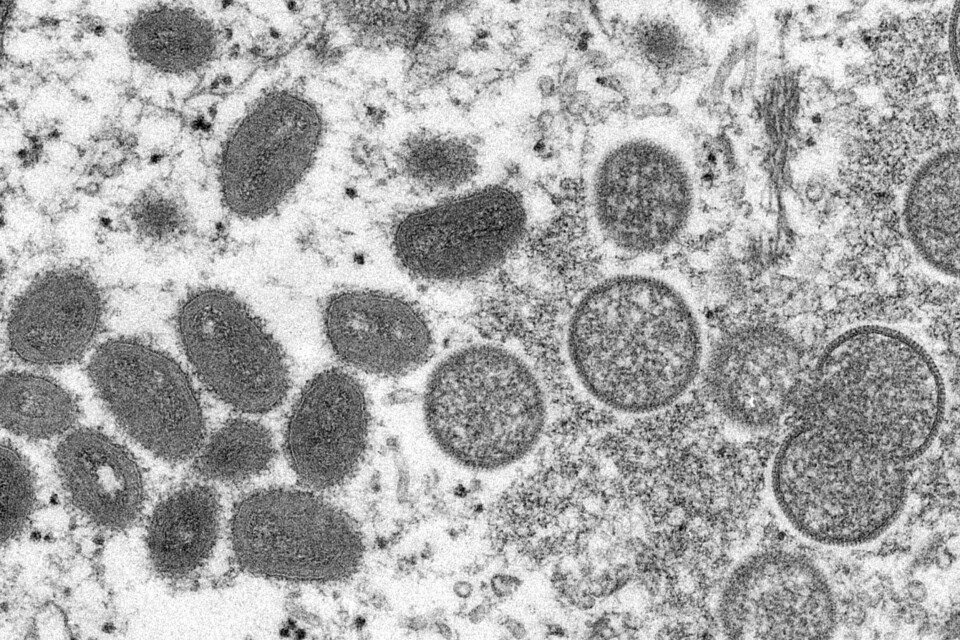 Apekopper smitter ved nær fysisk kontakt. Apekopper smitter ved nær fysisk kontakt. Foto: Cynthia S. Goldsmith, Russell Regner/AP/NTB