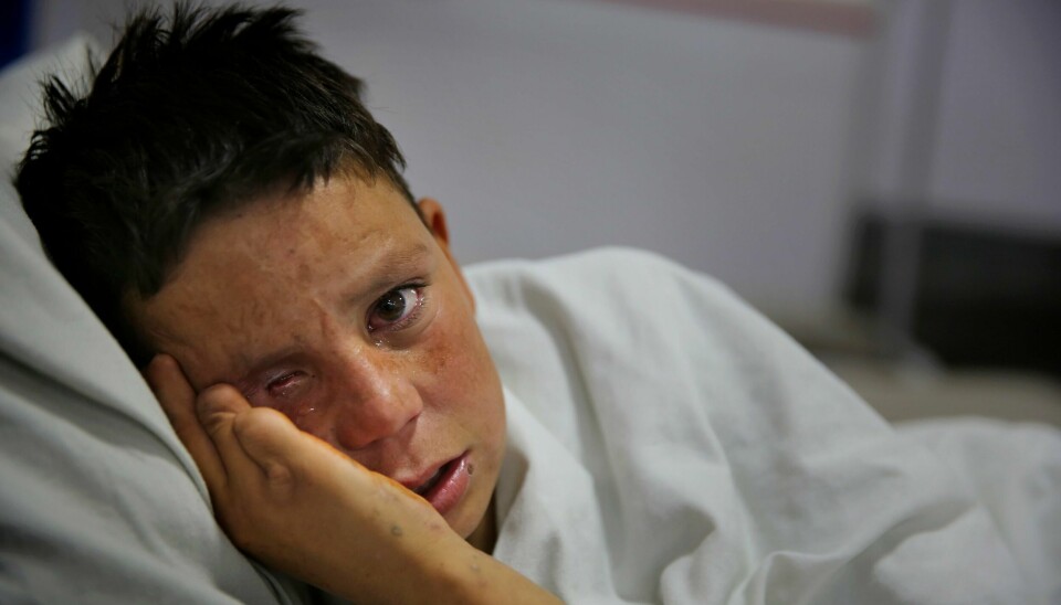 Farshid (13) gråter mens hans ligger i en sykehusseng i akuttsykehus for sivile krigsofre i Kabul i Afghanistan. Med en befolkning hvor nær 50 prosent er under 20 år, utgjør de unge en stor andel av livene som har gått tapt i flere tiår med krigføring i landet. Bildet er fra desember 2019. (AP Photo/Altaf Qadri)
