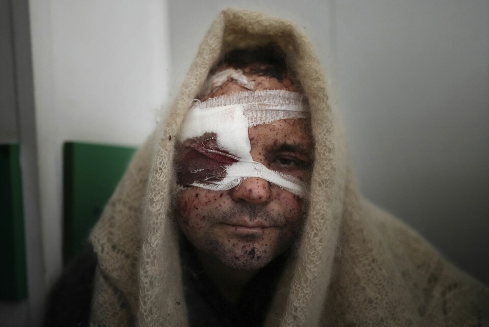 Serhiy Kralya, 41, ser inn i kamera etter en operasjon ved et sykehus i Mariupol fredag 11. mars 2022. Kralya ble skadet av russisk artilleriild. 41 år gamle Serhij Kralja ble såret under et russisk angrep mot Mariupol. Foto: Jevgenij Maloletka / AP / NTB